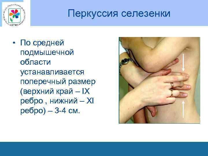 Перкуссия селезенки • По средней подмышечной области устанавливается поперечный размер (верхний край – IX