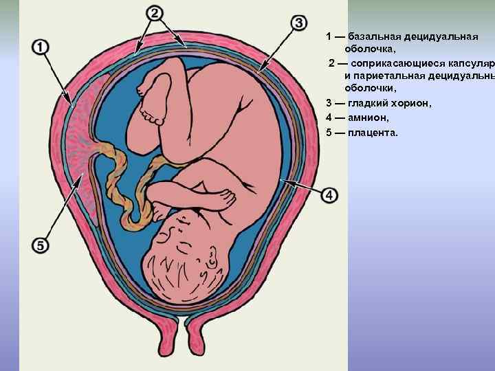 1 — базальная децидуальная оболочка, 2 — соприкасающиеся капсуляр и париетальная децидуальны оболочки, 3