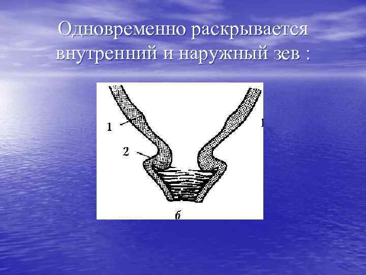 Одновременно раскрывается внутренний и наружный зев : 