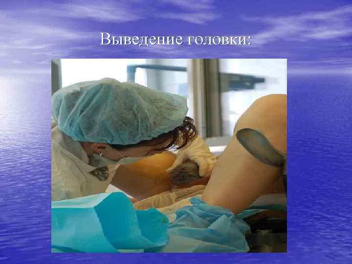 Выведение головки: 