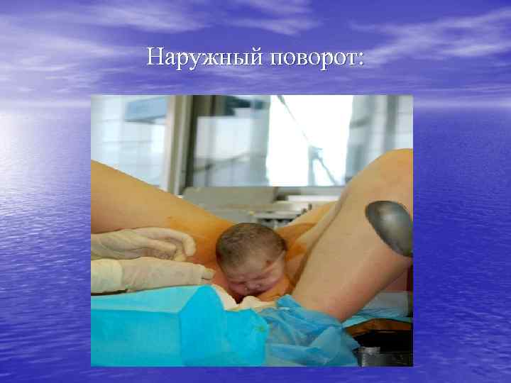 Наружный поворот: 