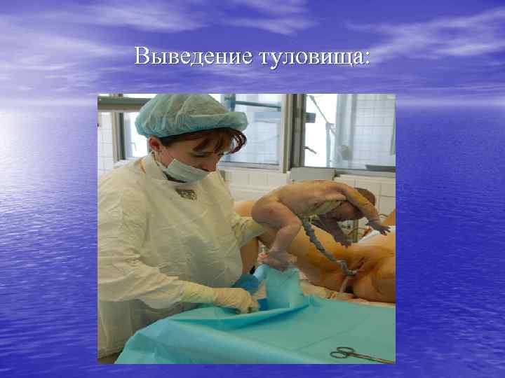 Выведение туловища: 