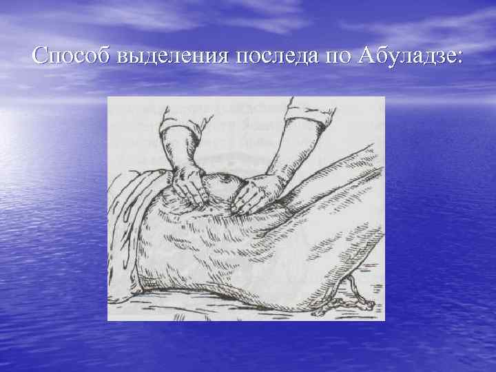 Способ выделения последа по Абуладзе: 