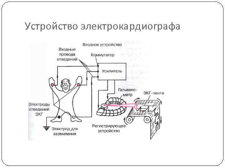 Устройство электрокардиографа 