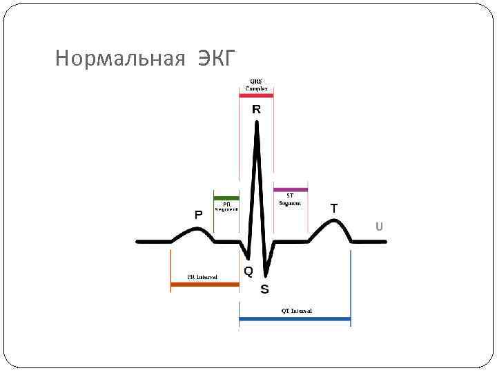 Нормальная ЭКГ 