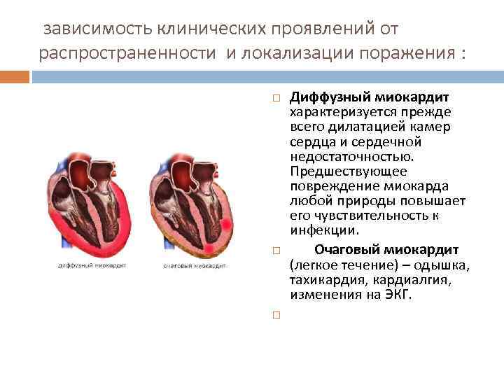  зависимость клинических проявлений от распространенности и локализации поражения : Диффузный миокардит характеризуется прежде