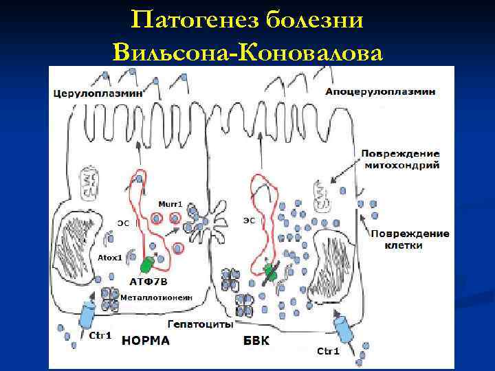 Болезнь вильсона коновалова патогенез схема