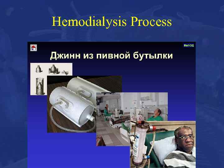 Hemodialysis Process 