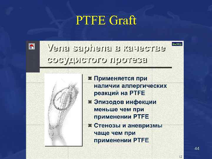 PTFE Graft 44 