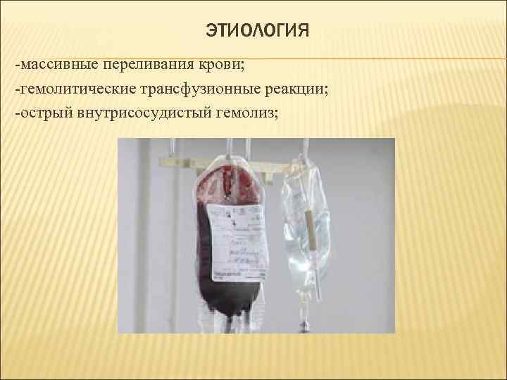 ЭТИОЛОГИЯ -массивные переливания крови; -гемолитические трансфузионные реакции; -острый внутрисосудистый гемолиз; 