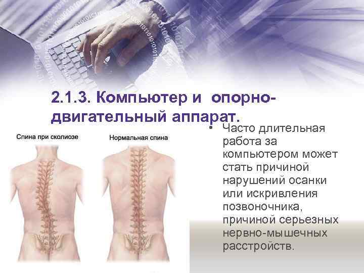 2. 1. 3. Компьютер и опорнодвигательный аппарат. • Часто длительная работа за компьютером может