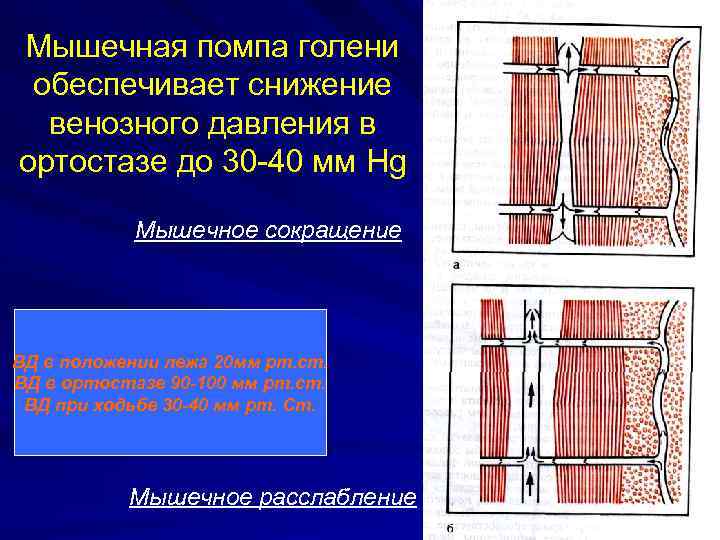 Мышечная помпа голени обеспечивает снижение венозного давления в ортостазе до 30 -40 мм Hg