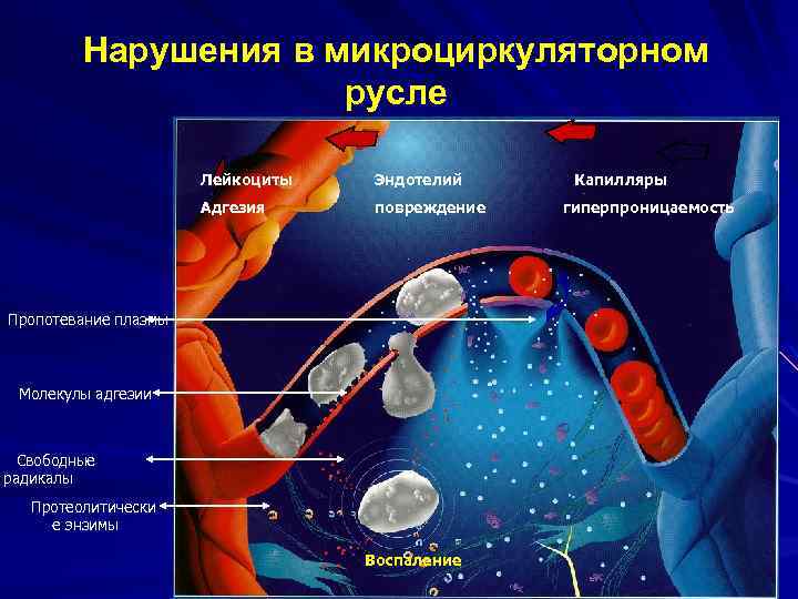 Нарушения в микроциркуляторном русле Лейкоциты Эндотелий Адгезия повреждение Пропотевание плазмы Молекулы адгезии Свободные радикалы