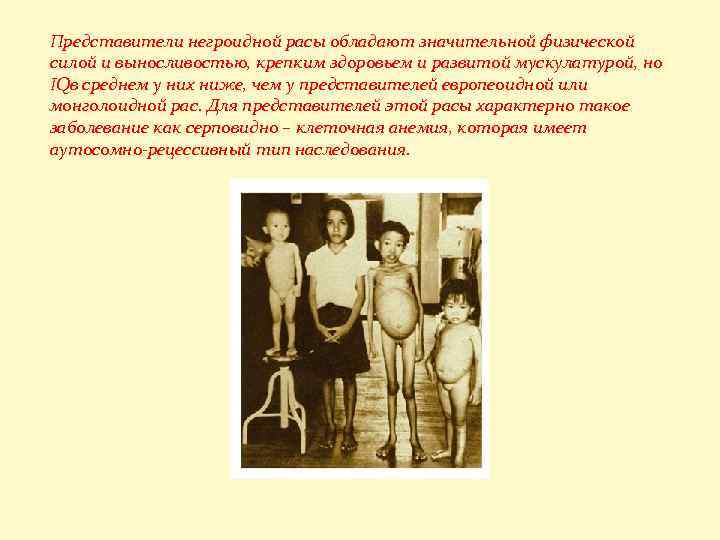 Представители негроидной расы обладают значительной физической силой и выносливостью, крепким здоровьем и развитой мускулатурой,