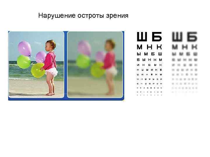 Нарушение остроты зрения 