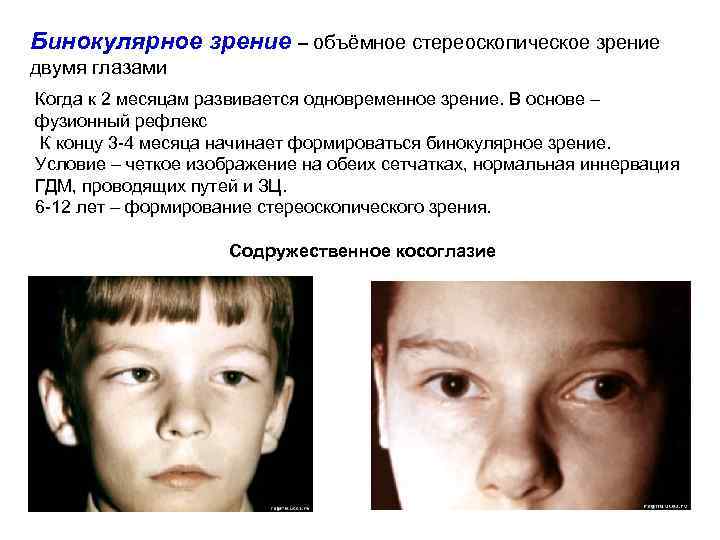 Бинокулярное зрение – объёмное стереоскопическое зрение двумя глазами Когда к 2 месяцам развивается одновременное