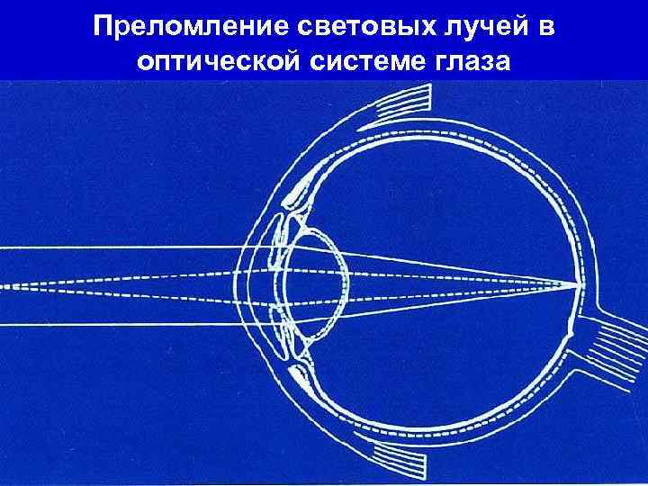Преломление световых лучей в оптической системе глаза 
