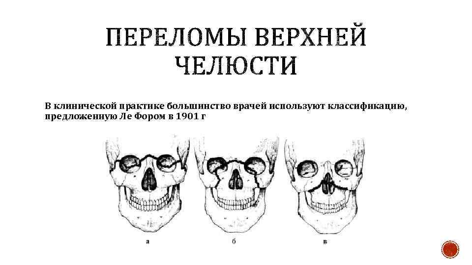 Перелом верхней челюсти карта вызова смп - 94 фото