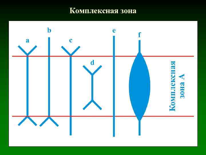 Комплексная зона 