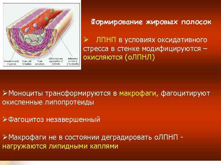 Формирование жировых полосок Ø ЛПНП в условиях оксидативного стресса в стенке модифицируются – окисляются
