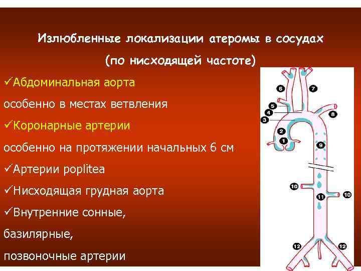 Излюбленные локализации атеромы в сосудах (по нисходящей частоте) üАбдоминальная аорта особенно в местах ветвления