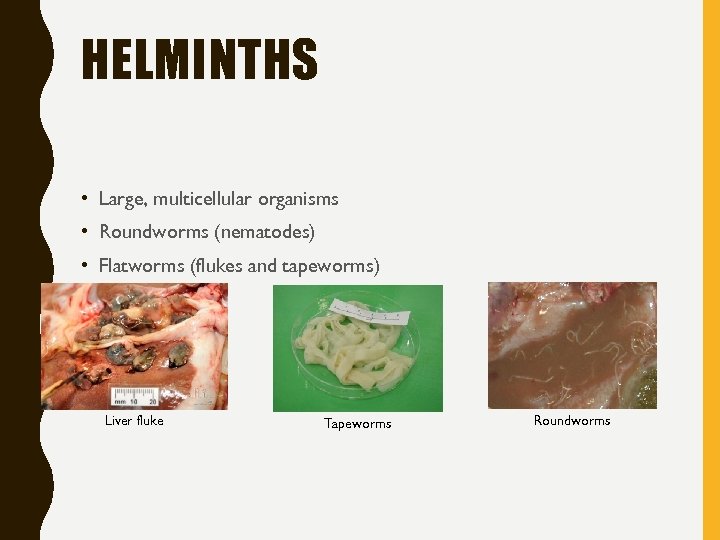 HELMINTHS • Large, multicellular organisms • Roundworms (nematodes) • Flatworms (flukes and tapeworms) Liver