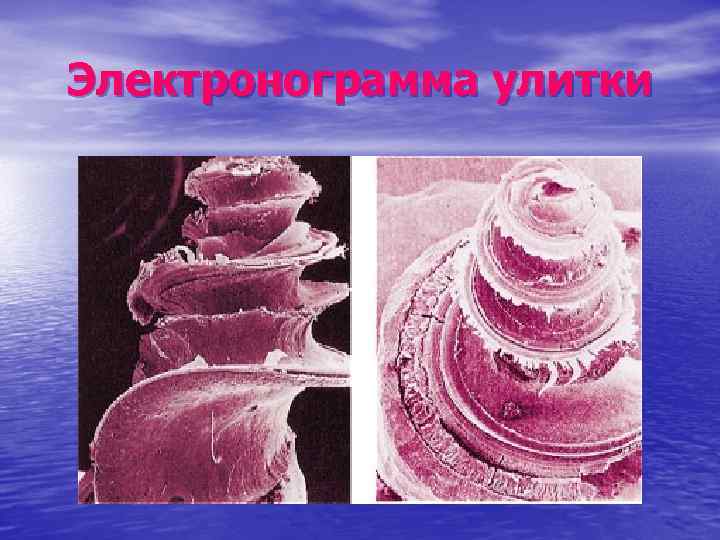 Электронограмма улитки 
