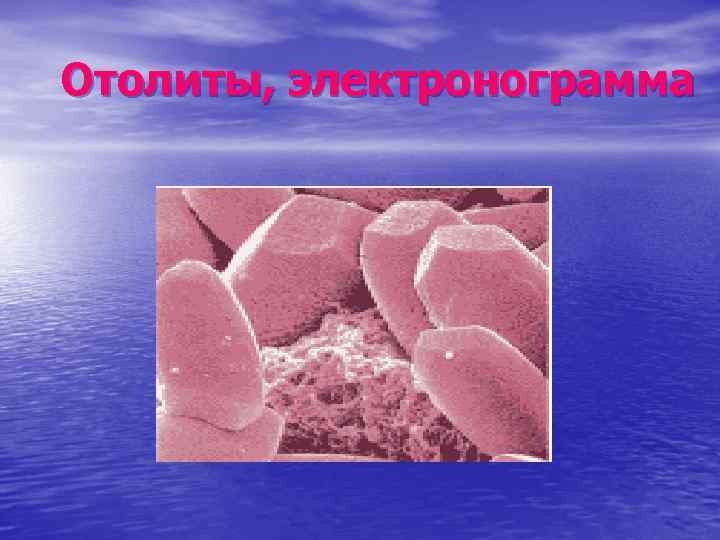 Отолиты, электронограмма 