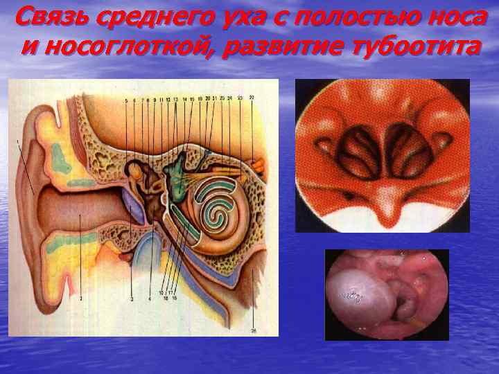 Связь среднего уха с полостью носа и носоглоткой, развитие тубоотита 