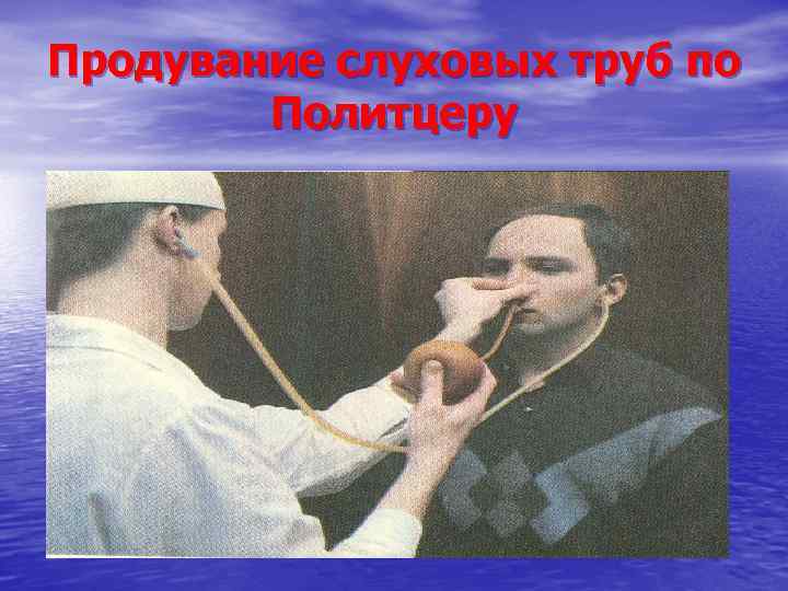 Продувание слуховых труб по Политцеру 