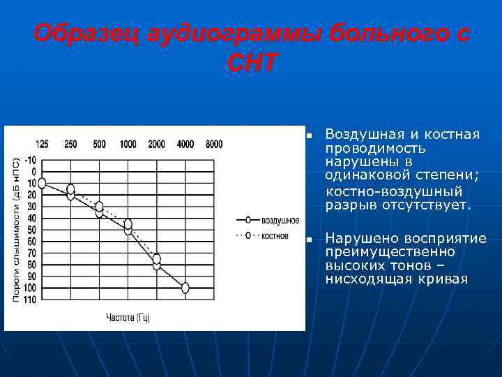 Образец аудиограммы больного с СНТ n n Воздушная и костная проводимость нарушены в одинаковой