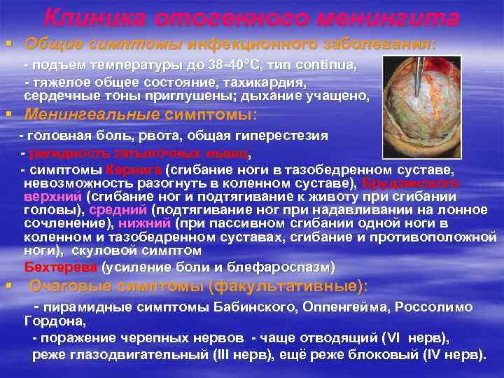 Клиника отогенного менингита § Общие симптомы инфекционного заболевания: - подъем температуры до 38 -40°С,