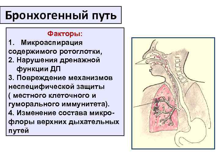 Бронхогенный путь Факторы: 1. Микроаспирация содержимого ротоглотки, 2. Нарушения дренажной функции ДП 3. Повреждение