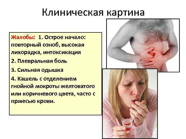 Клиническая картина Жалобы: 1. Острое начало: повторный озноб, высокая лихорадка, интоксикация 2. Плевральная боль