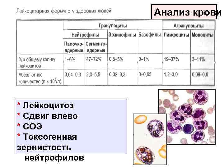 Анализ крови * Лейкоцитоз * Сдвиг влево * СОЭ * Токсогенная зернистость нейтрофилов 