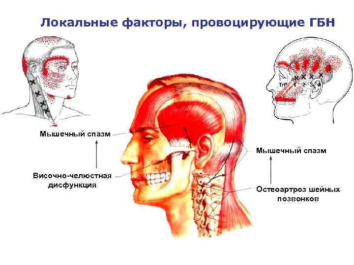 Височная головная