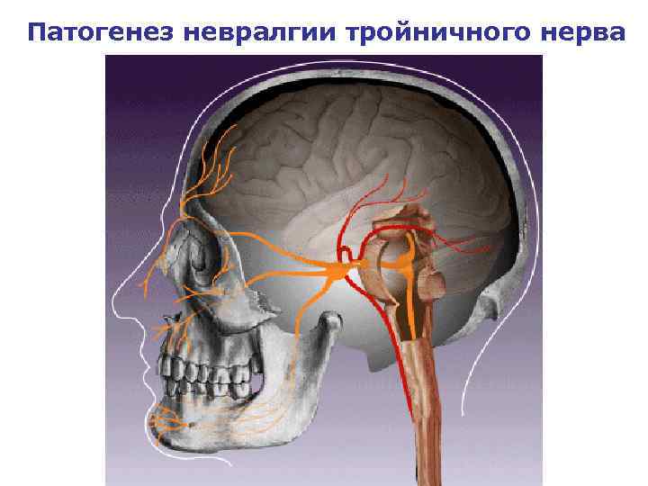 Патогенез невралгии тройничного нерва 
