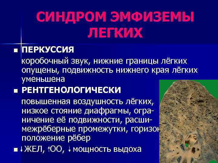 СИНДРОМ ЭМФИЗЕМЫ ЛЕГКИХ n n n ПЕРКУССИЯ коробочный звук, нижние границы лёгких опущены, подвижность