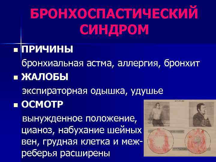БРОНХОСПАСТИЧЕСКИЙ СИНДРОМ ПРИЧИНЫ бронхиальная астма, аллергия, бронхит n ЖАЛОБЫ экспираторная одышка, удушье n ОСМОТР