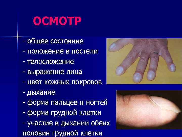 ОСМОТР - общее состояние - положение в постели - телосложение - выражение лица -