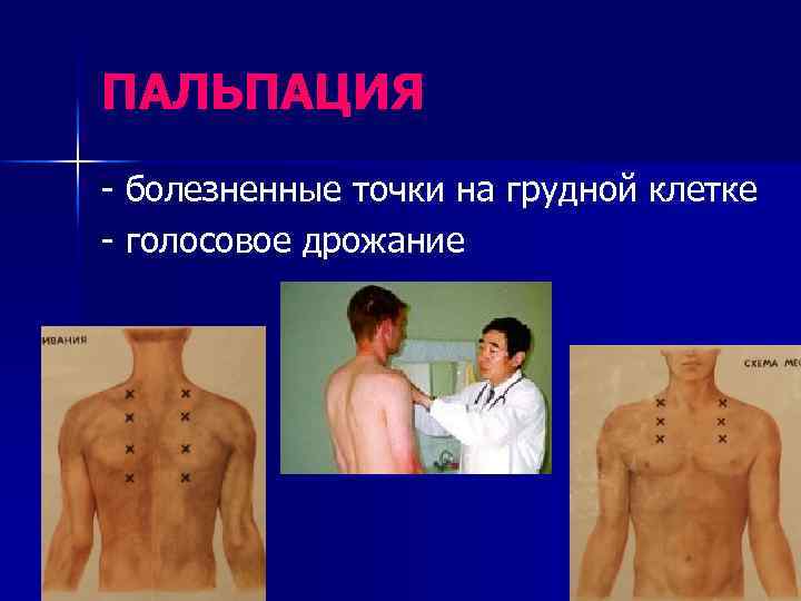 ПАЛЬПАЦИЯ - болезненные точки на грудной клетке - голосовое дрожание 