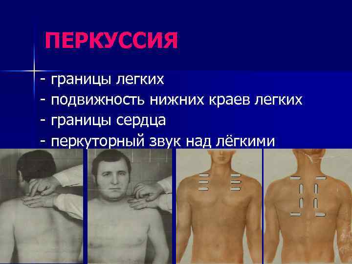 ПЕРКУССИЯ - границы легких - подвижность нижних краев легких - границы сердца - перкуторный
