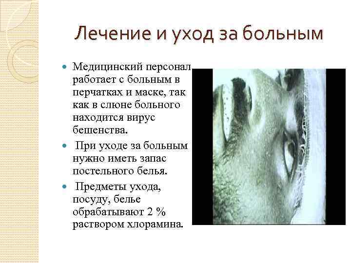 Лечение и уход за больным Медицинский персонал работает с больным в перчатках и маске,