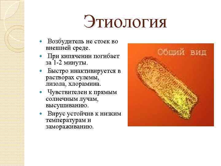 Этиология Возбудитель не стоек во внешней среде. При кипячении погибает за 1 -2 минуты.