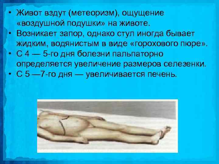  • Живот вздут (метеоризм), ощущение «воздушной подушки» на животе. • Возникает запор, однако