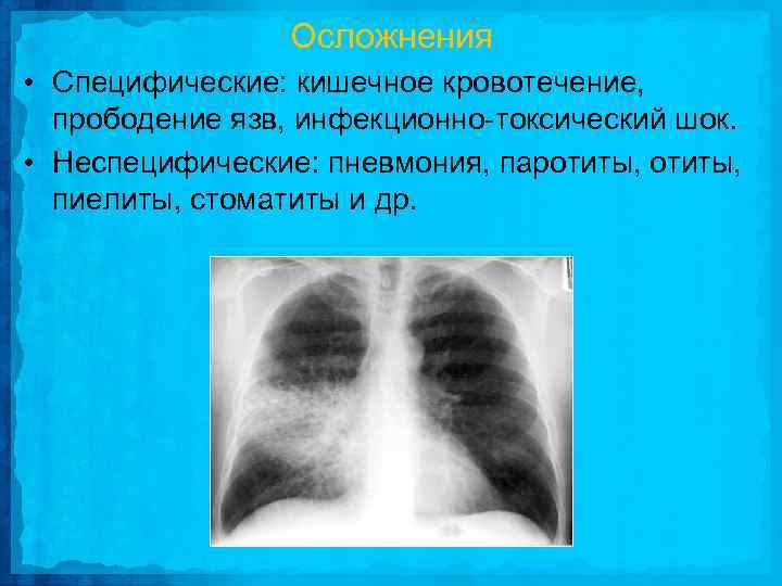 Осложнения • Специфические: кишечное кровотечение, прободение язв, инфекционно токсический шок. • Неспецифические: пневмония, паротиты,