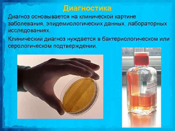 Диагностика Диагноз основывается на клинической картине заболевания, эпидемиологических данных, лабораторных исследованиях. Клинический диагноз нуждается