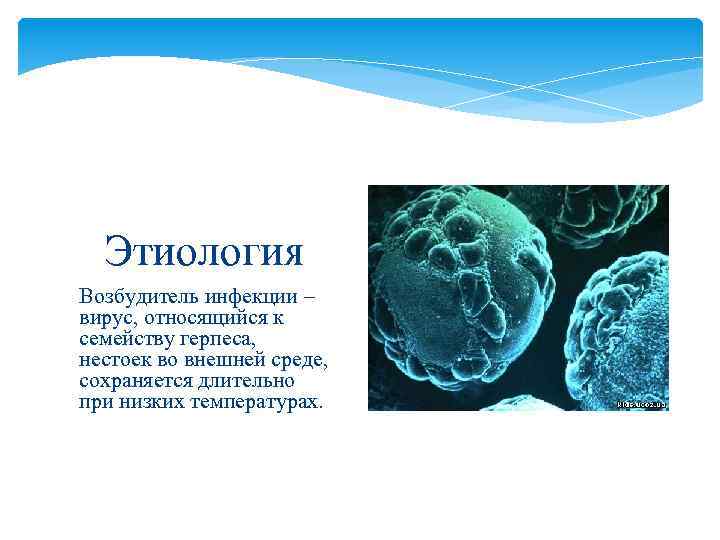 Этиология Возбудитель инфекции – вирус, относящийся к семейству герпеса, нестоек во внешней среде, сохраняется