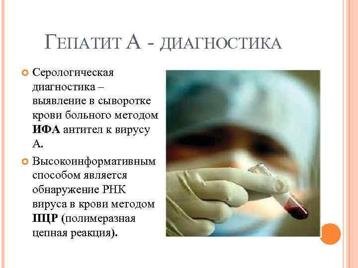 ГЕПАТИТ А ДИАГНОСТИКА Серологическая диагностика – выявление в сыворотке крови больного методом ИФА антител