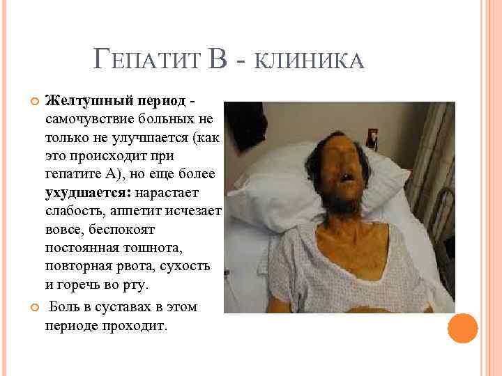 ГЕПАТИТ В КЛИНИКА Желтушный период - самочувствие больных не только не улучшается (как это